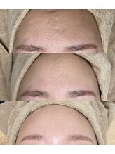 ミーミドットアイ(Mi-mi.i)/肌質改善【VOSサロンケア】