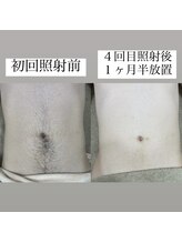 テンパ ビューティー(+10%beauty)/効果写真