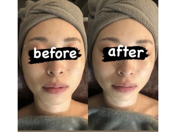 ディライト 名古屋駅店(Delight)/小顔ケア、引き締めたい