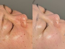 ルーナジェーナ(Luna llena)/池袋　エステ　ルーナジェーナ