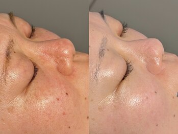 ルーナジェーナ(Luna llena)/池袋 エステ ルーナジェーナ