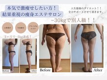 リアンビューティー(Lien Beauty)