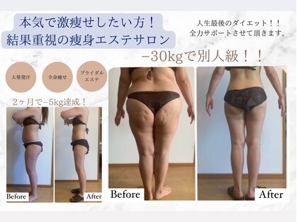 リアンビューティー(Lien Beauty)の写真