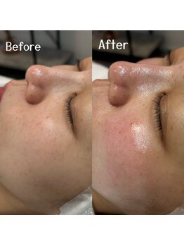 ブリエ(Briller)/白玉WAX