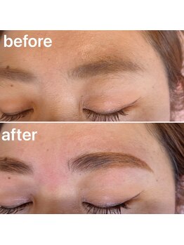 エバーグリーン(evergreen)/