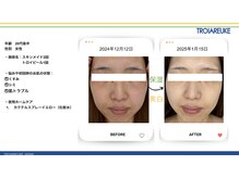 リトルーム(Litroom: from Seoul)/スキンメイド