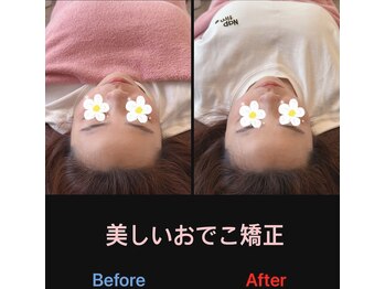 美容矯正サロン レレポノ(LELEPONO)/