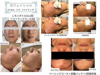 ベルスタイル(Bell style)/当店のお客様症例