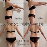 ヨサパーク アンソロジー(YOSA PARK anthology)