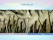 アンス(anth:)/お客様の仕上がり