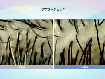 アンス(anth:)/お客様の仕上がり