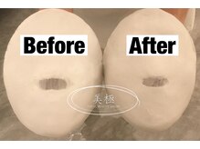 美極 トータルビューティー(美極 TOTAL BEAUTY)/恵比寿/小顔コルギ/エステ/