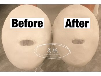 美極 トータルビューティー(美極 TOTAL BEAUTY)/恵比寿/小顔コルギ/エステ/