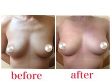 ブロッサム 山内店/オーナービフォーアフター公開☆