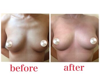 ブロッサム 山内店/オーナービフォーアフター公開☆