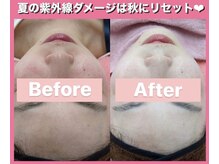 フェミニー(Feminy)/【美白】白雪姫