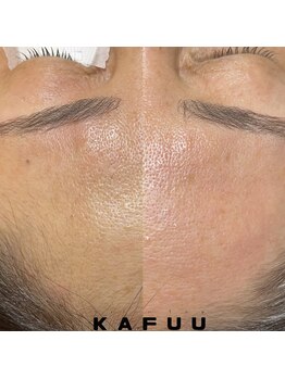 サロン ザ カフー(salon the KAFUU)/HBL&フェイスワックス
