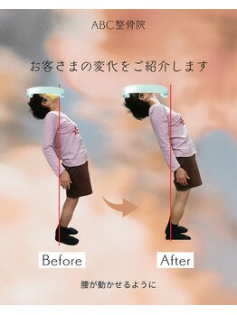 ABC整体院/腰痛整体のビフォーアフター