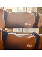 スリラ(SuriLa)/◆ビフォーアフター◆