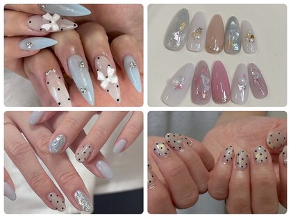 リノネイル(Rino-nail)の写真