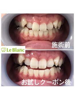 ルブラン 奈良店(Le Blanc)/遠方のお客様！