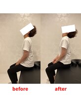 ナオル整体 福岡香椎院(NAORU整体)/40代女性施術事例【首の痛み】