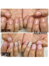 モアナ 池袋(MOANA)/人工爪深爪