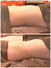 エミナル(EMINAL)/腸もみ