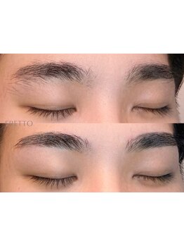 メンズフェイシャル