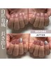 【新規】すぐに見違える深爪矯正 指先から見える人工爪3mm カラーリング有り