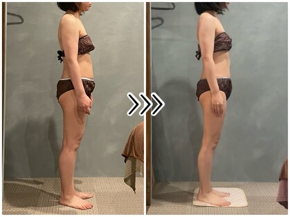 ツーアップ(2up)の写真