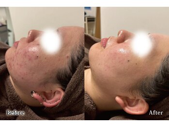 アネル 浦添店(anel)/