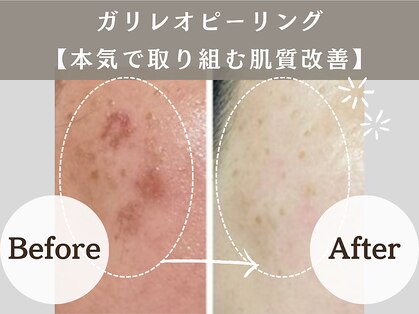 アンジュ(ANGE)の写真