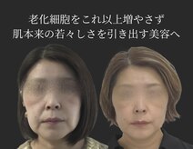 ミヨン(miyong)
