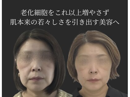 ミヨン(miyong)の写真