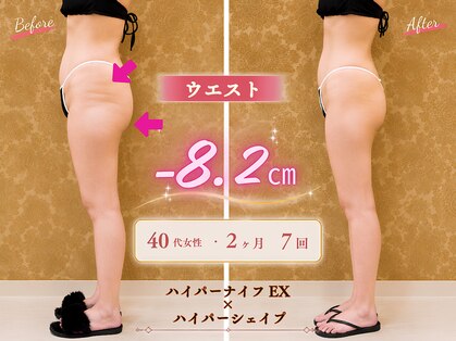 エピファニー(Epi phany Total Beauty Salon)の写真
