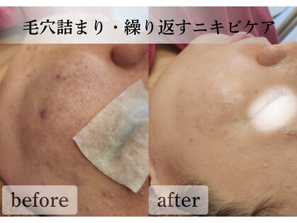 アナシアビューティーサロン(Anacia)の写真