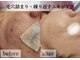アナシアビューティーサロン(Anacia)の写真