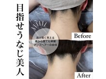 ルウム 名古屋駅店(lum)/脱毛lum/うなじ　Before/After