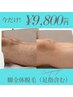 【男性限定】夏の短パン対策！脚全体脱毛（足指含む）¥9,800