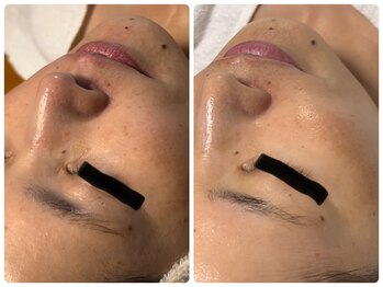 ベルドア(Bell Door)/エイジングケア◎