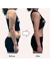 じぶんdeエステ 横浜店/姿勢改善！バストアップも叶う！