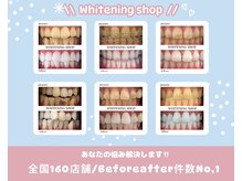 ホワイトニングショップ 福岡春日店の雰囲気（お客様に寄り添い、1人1人合わせたカウンセリングをします◎）