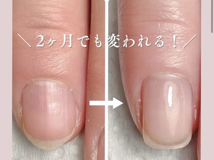 サンネイル(Sun nail)の写真
