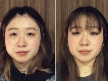 美容整体ウェリナ 中川八田院/小顔矯正/骨盤矯正/痩身整体