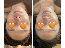 ノレーヴ(NOS REVES)の雰囲気（1回の施術　お1人おひとりに合わせたお肌やお身体を見極めてケア）