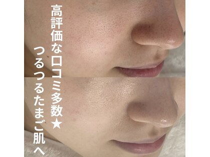 プラセル(Placer)の写真