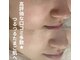プラセル(Placer)の写真