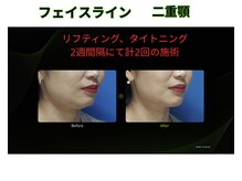 キートス(Kiitos)の雰囲気（真皮層から肌質改善/小顔/毛穴,黒ずみ/しみ/しわ/たるみ改善◎）