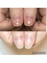 シャルム 本厚木(charme)/自爪育成ジェルコース